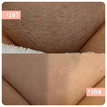 Myne - ערכת גילוח בטיחותית למניעת גירוי וחתכים